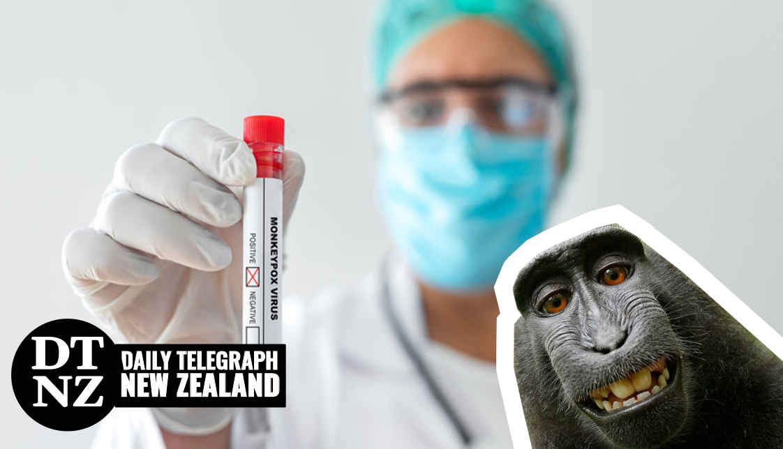 Monkeypox renamed news