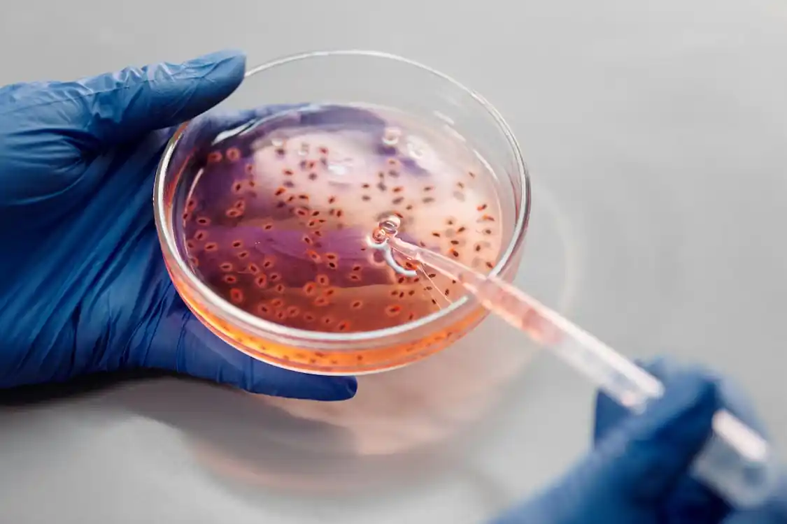 One Case Of Candida Auris Detected In New Zealand Daily Telegraph NZ   One Case Of Candida Auris.webp