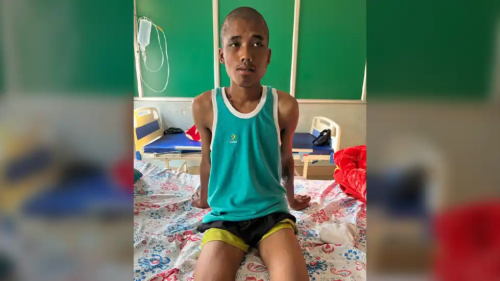 Davi Liansiangoun, a Kuki lad from Churachandpur district, who was attacked by armed Meitei men in Imphal and given up as dead by security forces. ©. PHOTO SUPPLIED.