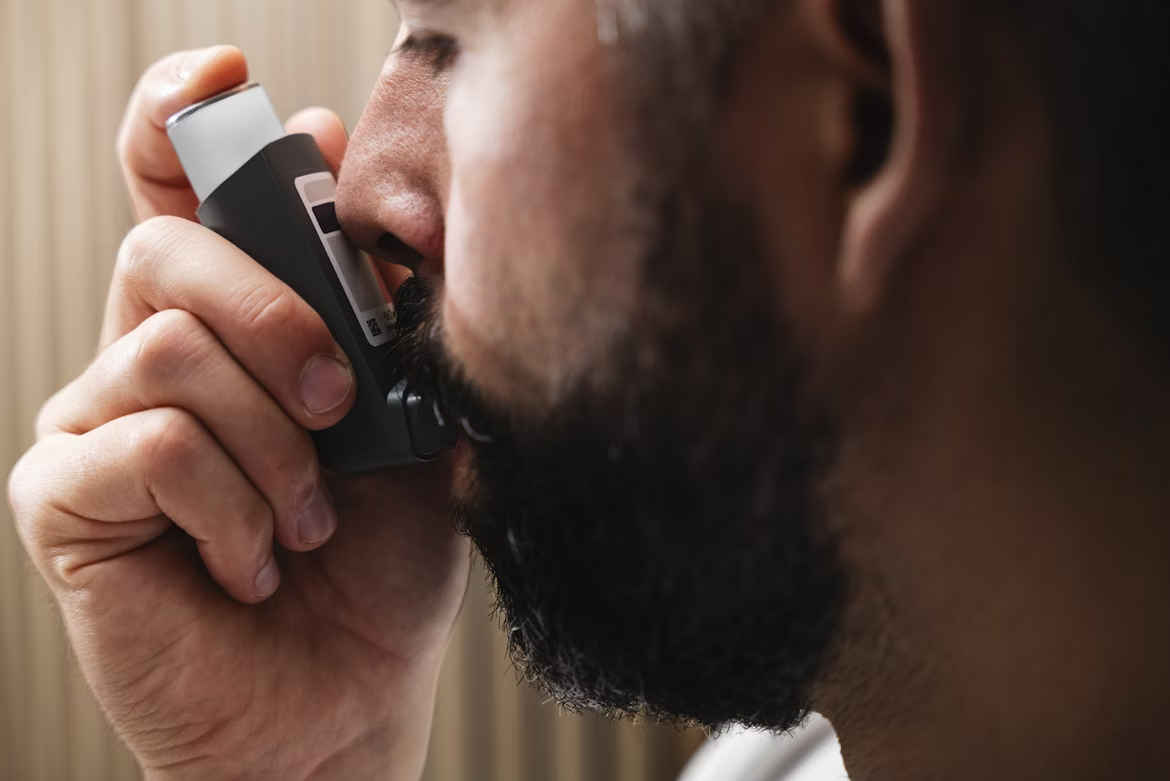 UK asthma opinion