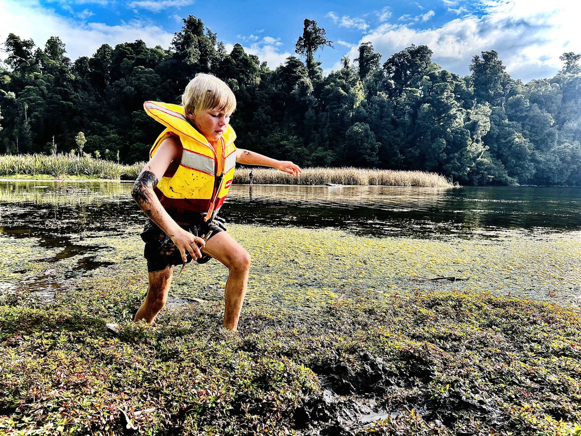 Type 1 Diabetes opinion