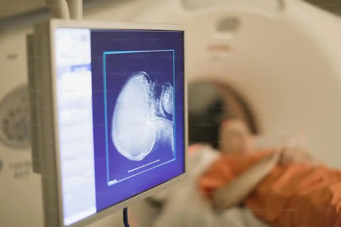 Union blames health NZ digital cuts for major hospital IT outage 1 Health NZ IT cuts blamed for massive outage