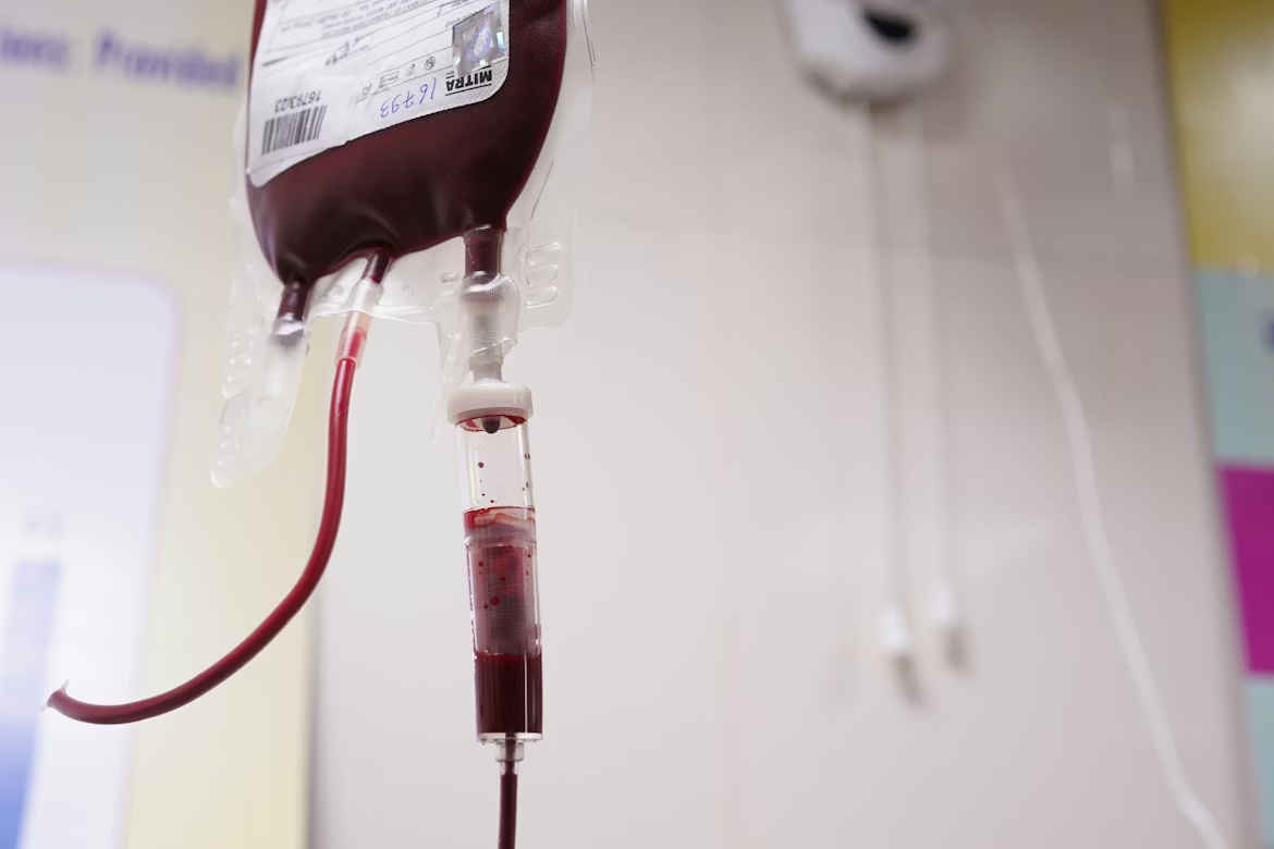 COVID mRNA jab concerns drive rise in US blood transfusion refusals 1 Covid vaccinated blood transfusions