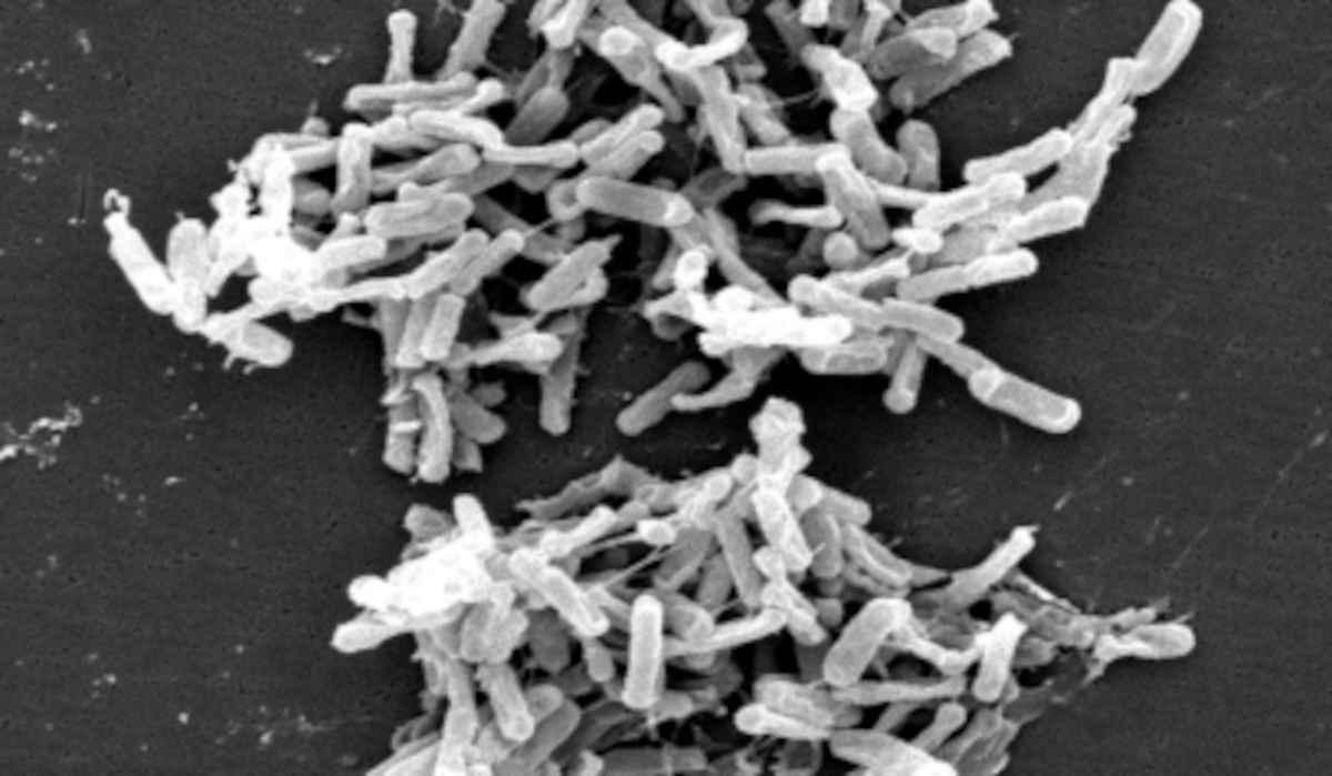 Canterbury students food poisoning