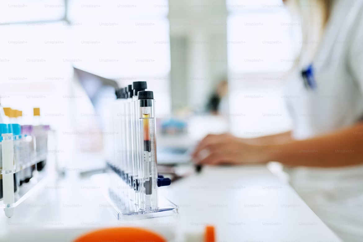 Ebola vaccine development