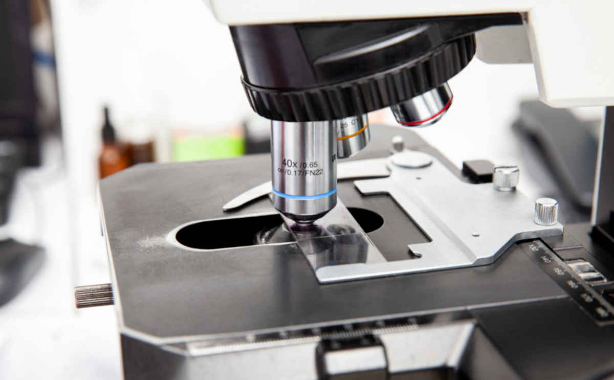 Cervical screening